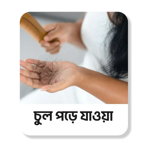 চুল পড়ে যাওয়া