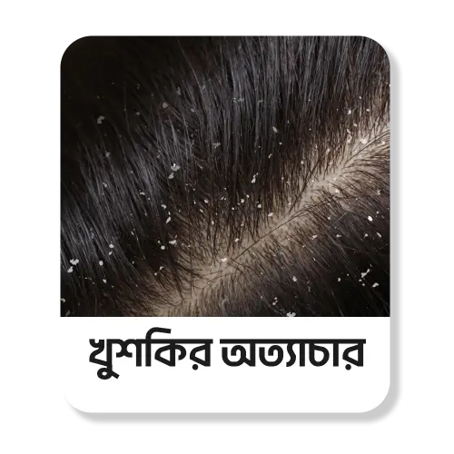 খুশকি ও চুলকানি