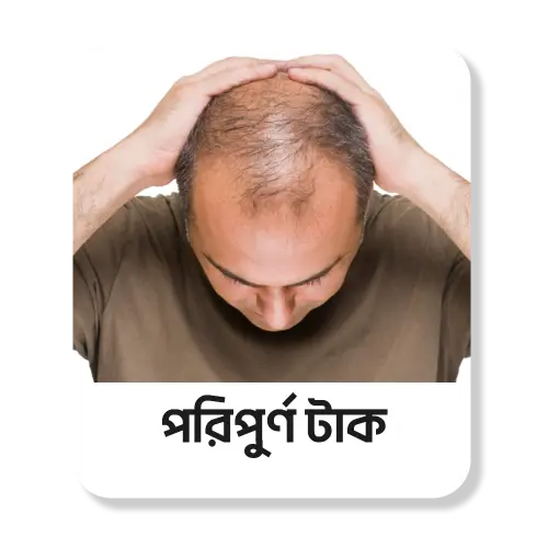 চুল পেকে যাওয়া